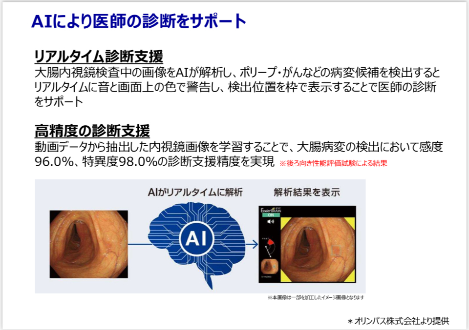 AIにより医師の診断をサポート